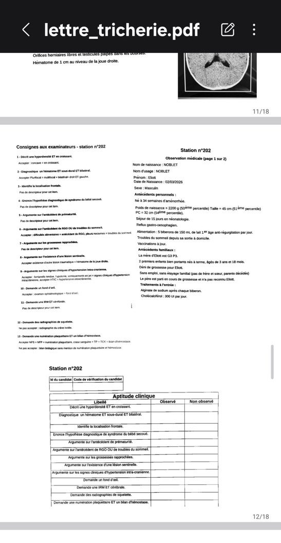 Dermatopoullos's tweet photo. Des fuites aux ECOS ? qui aurait pu prévoir ? @ANEMF ? Vous n’y pensez pas…  

Organisées dans des conditions hétérogènes, elles ne peuvent évidemment pas constituer une épreuve classante équitable. 

Avec de tels écarts de moyens, d’encadrement, d’examinateurs ou de confidentialité des stations, la performance mesurée dépend INÉVITABLEMENT de facteurs extérieurs aux compétences de l’étudiant

Tant que  l’équité, la standardisation nationale et la sécurité des sujets n’est pas garantie, les ECOS ne doivent pas faire partie d’un concours classant 
(Elles n’aurait jamais dû l’être)

Les ECOS sont injustes