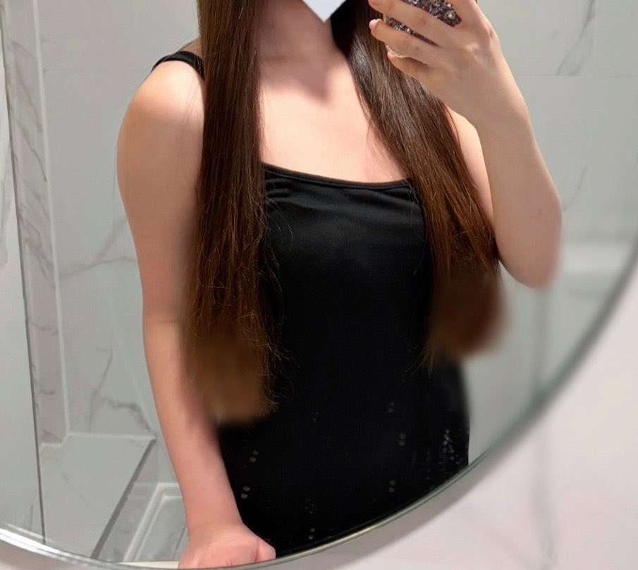 a0000149's tweet photo. エッジラインで二の腕＋脇＋副乳脂肪吸引しました！❤︎
二の腕の脂肪が気になってたので やって良かったです🎶🩷🩷
日に日に細くなってきてます🫶🏻🤍🤍

 #二の腕脂肪吸引
＠edgeline_jpkr https://t.co/4kIoaPG3et