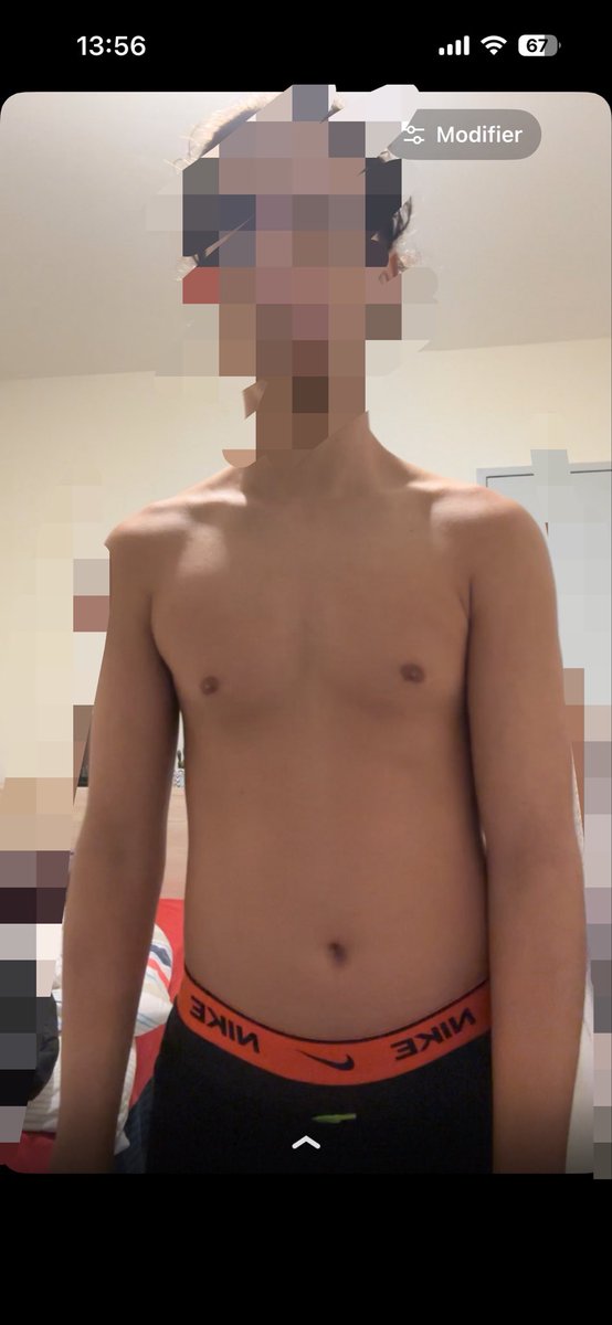 ZIN0NIX's tweet photo. Les skinny et skinny fat de ma TL lâchez rien les frr, je vous met mon évolution si ça peut en motiver ❤️❤️❤️ focus les brother https://t.co/bdZlQYZJek