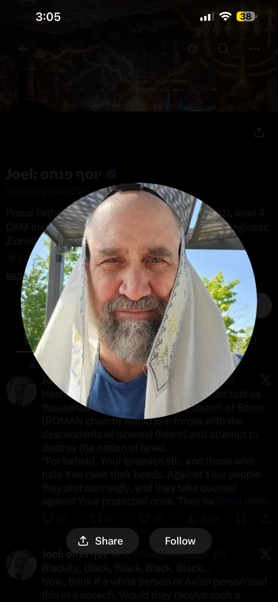 saye3boy's tweet photo. @Blueeyedbull56 @israel_advocacy your talking about inbred individuals? just look at your fucking retarded pfp https://t.co/MFDKTr8USq