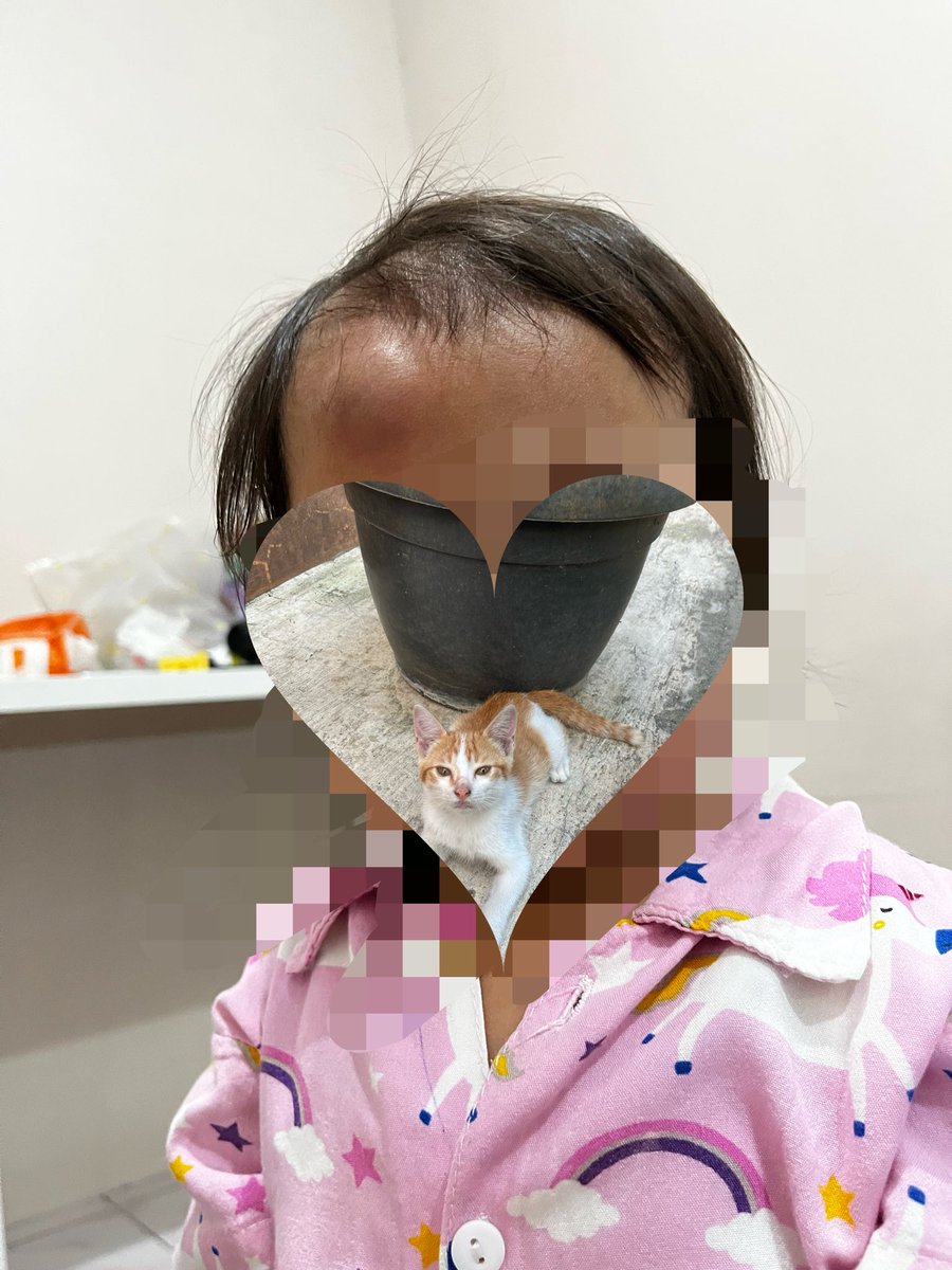 childishlyyy's tweet photo. Cokkkk! Kemarin malem anak gua jatuh dan kepalanya benjol bener2 benjol menonjol biru😭 gua gak hanya panik takut dia kenapa2 tapi lgsg ovt takut diomelin mertua juga. Tapi Allah maha baik benjolannya kempes dan tersamarkan pagi ini. https://t.co/BG8XGKFpzg