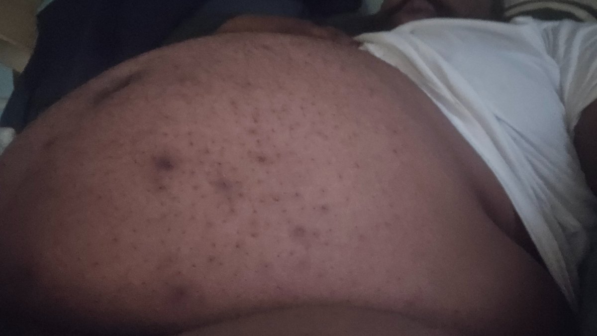 RexTheFirePup's tweet photo. @TheBellyPopper https://t.co/94AqmfE0cV