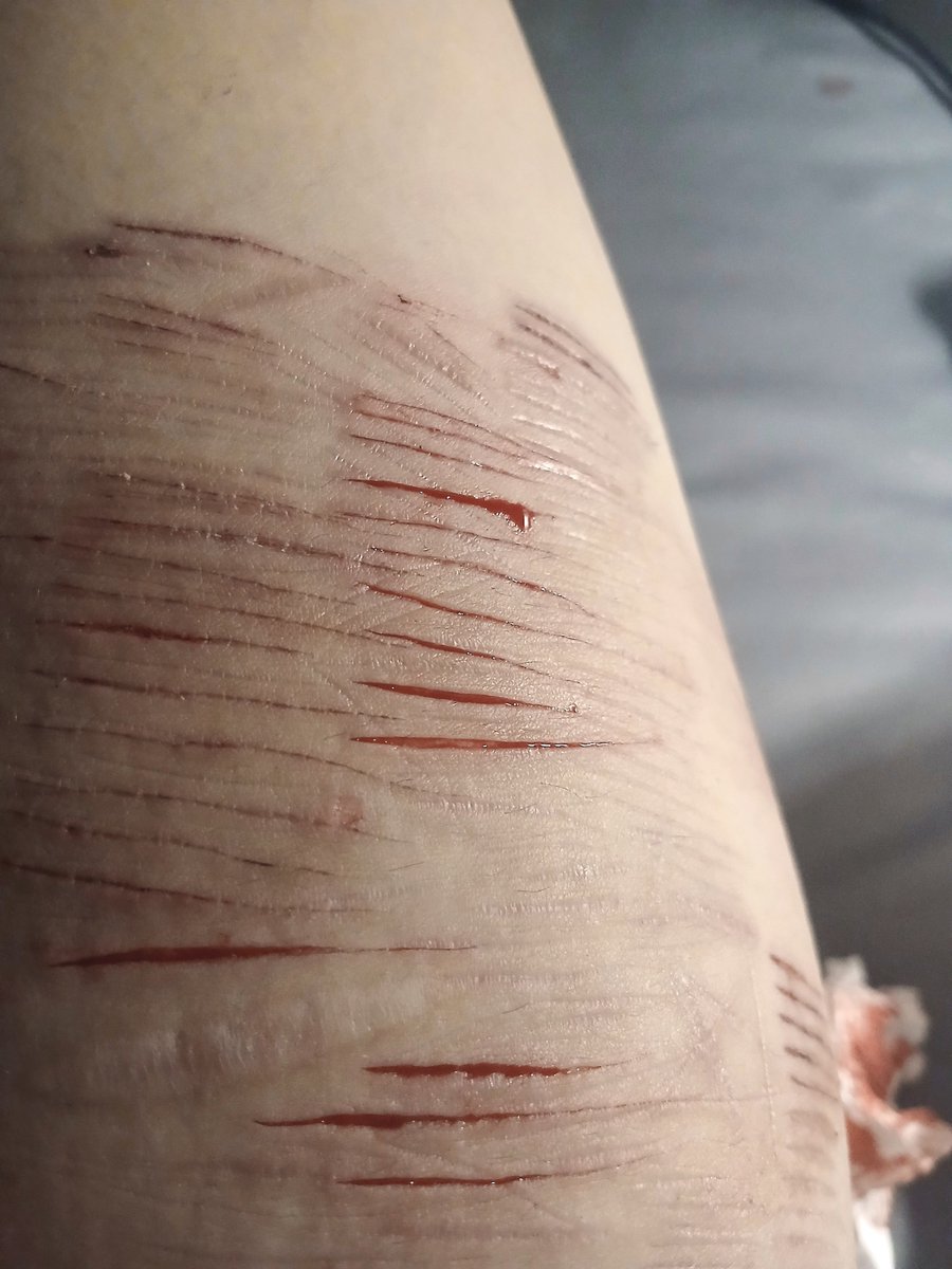 Beoungu's tweet photo. All fake sfx makeup #988twt https://t.co/IJG9l56OXw