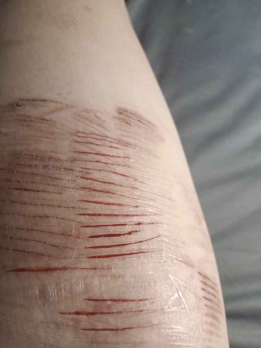 Beoungu's tweet photo. All fake sfx makeup #988twt https://t.co/IJG9l56OXw