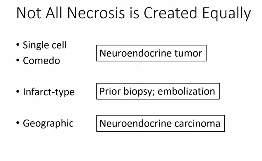 Janiranavarro's tweet photo. WHAT'S NEW IN NEUROENDOCRINE TUMORS (WHO 6TH EDITION 2026)
Assess presence/abscence of necrosis: Not all necrosis are equal 

-Single cell/comedo: NET
-Infarct type: Seen in setting of prior biopsy/embolization
-Geographic: NEC

Dr. Bellizzi GIPS pathcast https://t.co/hVmAzdKI6O #pathology #PathX