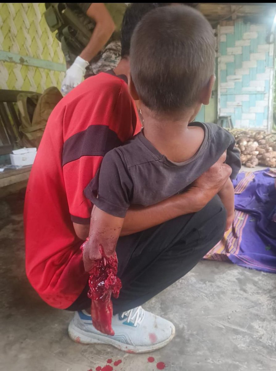 DynastyDoungel's tweet photo. Shri Losii Dikho @LDikho51792 
Hon'ble Deputy Chief Minister,
Government of Manipur*l

Subject: Appeal to stop attacks on unarmed civilians in Tamenglong District.

Sir,
Instead of creating unnecessary controversies on a daily basis, which you and your colleague Naga MLAs would never do, you are requested to kindly convey a clear message to the cadres of the Tangkhul-led NSCN-IM and its affiliate, ZUF-Kamson, to immediately stop attacking and killing unarmed innocent civilians, including women, children, and elderly persons, as was done in L. Tollen and Longpi villages in Tamenglong District.

If they have the courage to fight, they should face their male counterparts, as demonstrated by the Kuki-Zo Village Volunteers.

It is deeply shameful to celebrate after killing women, children, and old people.

@AwangbowNewmai @KhashimVashum @ErKeishing @Ahempanmei2 @LDikho51792 @YKhemchandSingh @KonthoujamG @LokBhavManipur @TheSangaiExpres @PoknaphamNews @meiteiheritage @koubru_lakpa @Paari_Athouba @laimacha @Nagaland_India @Nagaland_Post @NagalandPage @morungexpress05 @MorungExpress @tangkhulnews @rlungleng @Khanuithot_Khon @UNCNaga @UNC_Naga @UNCNaga @PMOIndia @HMOIndia @rashtrapatibhvn @PIBHomeAffairs @GoI_MeitY @MIB_India @BDUTT @vijaita @TanushreePande @ShashiTharoor @virsanghvi @KaranThapar_TTP @NELiveTV @republic @themojostory @TimesNow @ndtv @republic