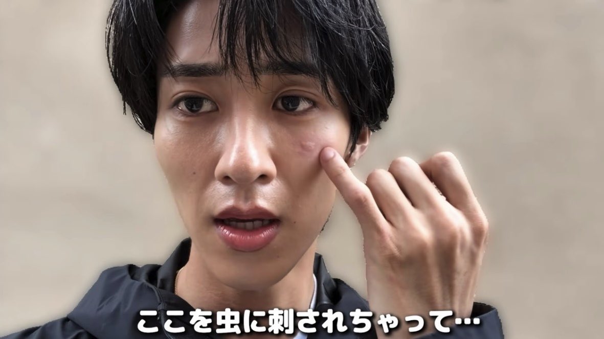 shunchanred's tweet photo. 虫にもモテる舜ちゃん❣️ https://t.co/Ogp86CQVNX