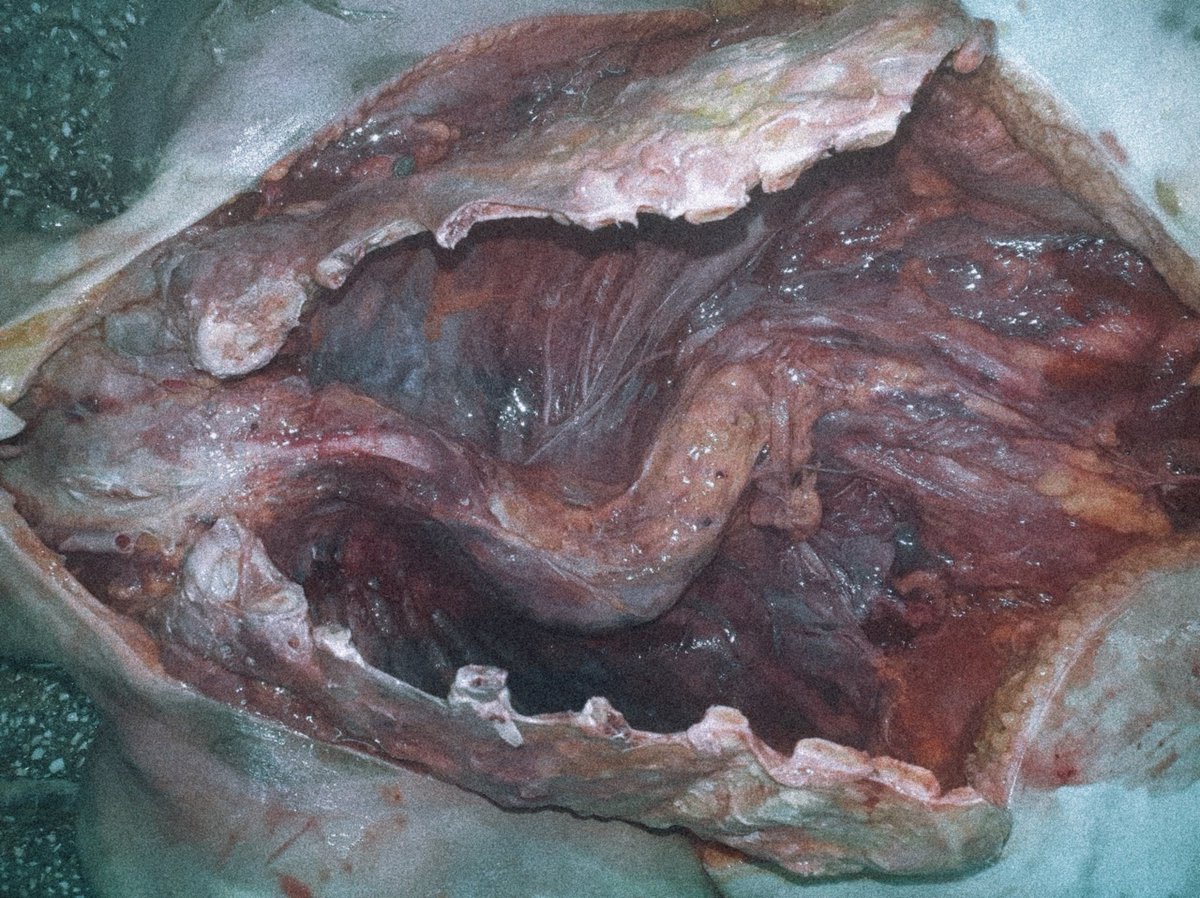moriitician's tweet photo. deformation of the spinal column in a corpse. •˚꩜｡
( horror prop / sfx art ) https://t.co/ZBnviA0dFu