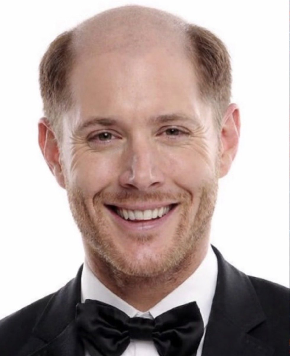 TheBoysOOCC's tweet photo. New HD look at Jensen Ackles  “barber” photo for hair transplant. https://t.co/EpqUr0d3YQ