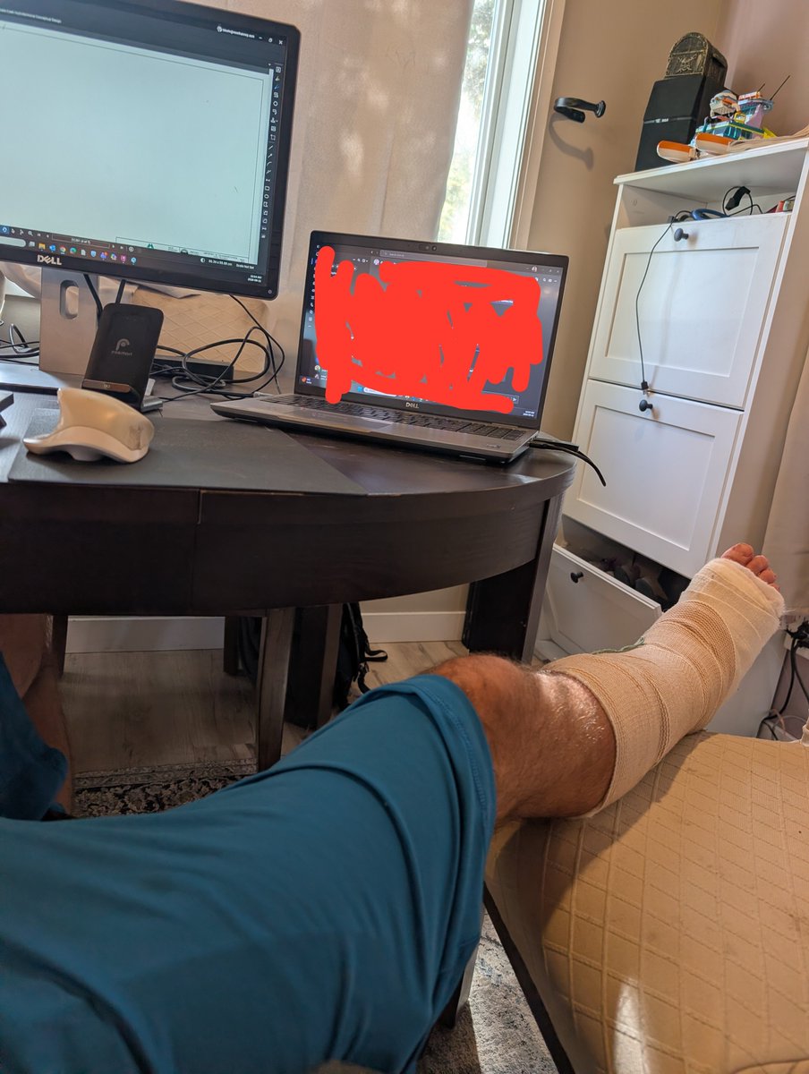 cadintentions's tweet photo. **Ankle Surgery Journal — Days 2 & 3**

September 11–12, 2026

Well... I may have spoken too soon. 😂

I woke up on Day 2 with noticeably more pressure and pain in my ankle.

Nothing terrible, and conveniently it was almost time for my next scheduled medication anyway.

I took it, managed another hour or two of sleep, and thought:

**"Maybe this is where the pain levels out."**

Midday update:

It did not level out.

Day 2 ended up being the most uncomfortable day so far.

The pain has changed from the general soreness of the first couple days into more pulsing pressure around the surgical area, mixed with occasional sharp, nerve-like sensations.

It comes in waves too.

One minute I'm reasonably comfortable...

The next my ankle is VERY aware that someone spent 90 minutes rebuilding it a couple days ago.

On the positive side, I actually managed to work most of a normal day from my temporary upstairs workstation.

I took breaks to lie down and elevate the leg, but overall the setup worked surprisingly well.

That's a win.

---

**Day 3 was different.**

Not necessarily because of the ankle itself, but because this was the first day I really felt like I was missing out on normal life.

It's Saturday.

Beautiful outside.

My daughter's gymnastics started today.

Normally I'd be doing something with the kids, working in the yard, running errands, or finding another excuse not to sit still.

Instead...

I'm on the couch or in bed with my leg elevated. The depressive and generally down feelings are much more prevalent. 

My wife has been amazing handling the kids, errands, food, and everything else while I'm temporarily useless.

But that's also been harder mentally than I expected.

I feel unable to help, lonely and generally low.

When you're working during the week, there's something to focus on.

I even decided to try and vacuum/mop the floors for some reason today while everyone was out running errands… it wasn't a good idea..

When it's Saturday and everyone else is going about their lives, being told to lie down and do absolutely nothing suddenly feels a lot more restrictive.

Add poor sleep, discomfort, medication, and restlessness together and today has probably been the toughest day mentally so far.

Sleep is slowly improving, though.

And despite a rough couple of days, I'm still only three days removed from surgery.

That's something I keep reminding myself.

This isn't the part where I'm supposed to be getting back to normal yet.

Right now my job is basically:

Keep the leg elevated.

Rest.

Let it heal.

Manage the pain.

And apparently learn how to sit still for longer than 30 minutes...