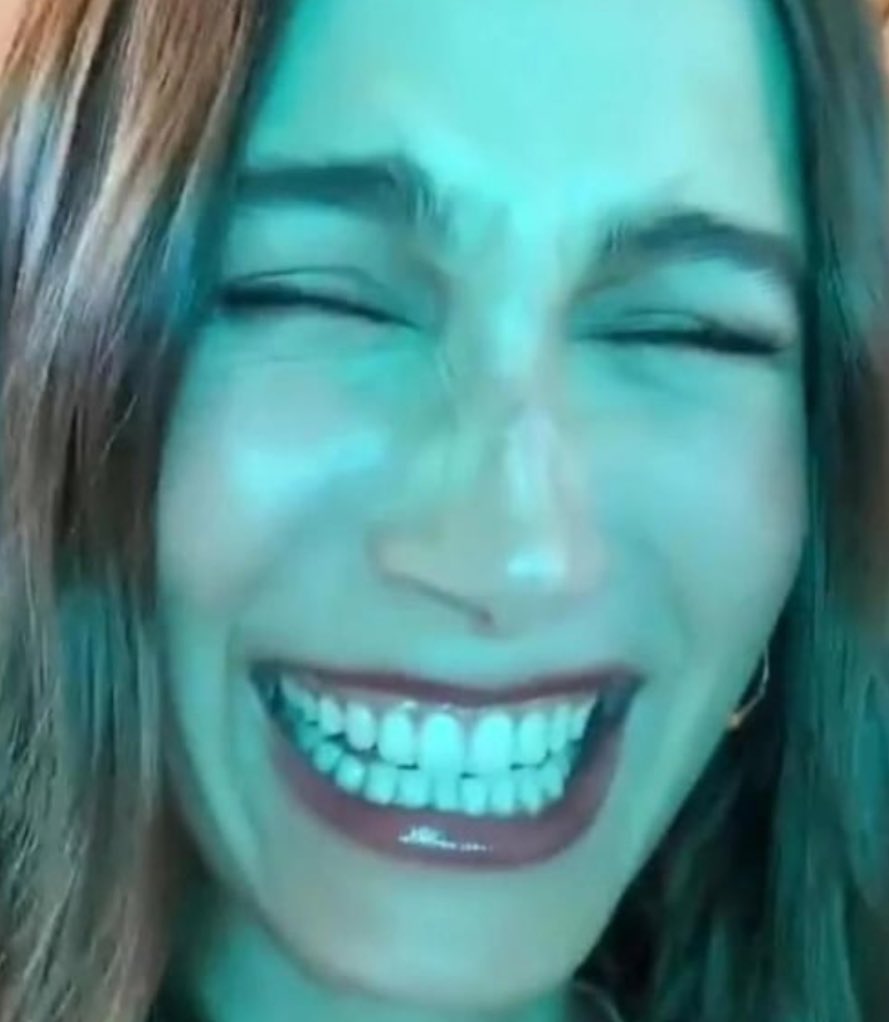 lohanthegirlie's tweet photo. quando a hailey bieber virou piada por ter muitos dentes e seu marido justin bieber ao invés de defendê-la ajudou a humilhar ela😭 https://t.co/TFT9lvhENB