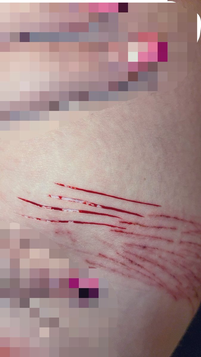 shtwmyb's tweet photo. I’m such a fat fucking chud I need to lock in and lose weight. Tiny sesh from the other day. All fake!! SFX makeup!! Not real!! #sh #shedtwt #shtwt #styrotwt #styro https://t.co/8igTf6UyQy