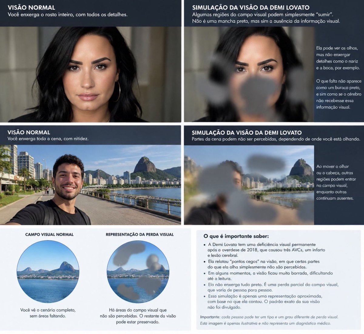 poptime's tweet photo. Imagem que mostra como supostamente Demi Lovato vê depois de sua overdose deixa internautas tristes. https://t.co/Jey21GOH39