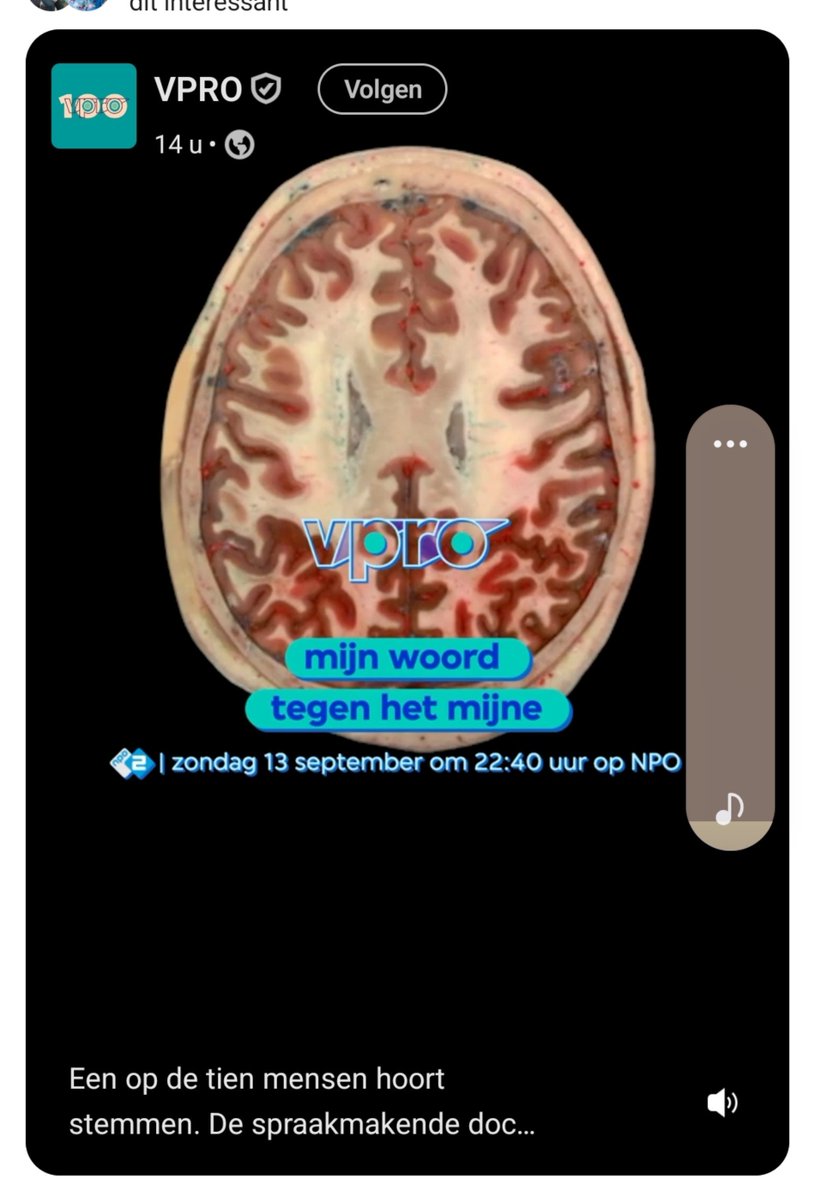 SJEerhart's tweet photo. Tv tip voor straks
Indringende rapportage over mensen die #stemmen horen
Maar liefst 1 op de 10 mensen hoort stemmen๐
#psychiatrie #npo https://t.co/ysvk1mXyTS