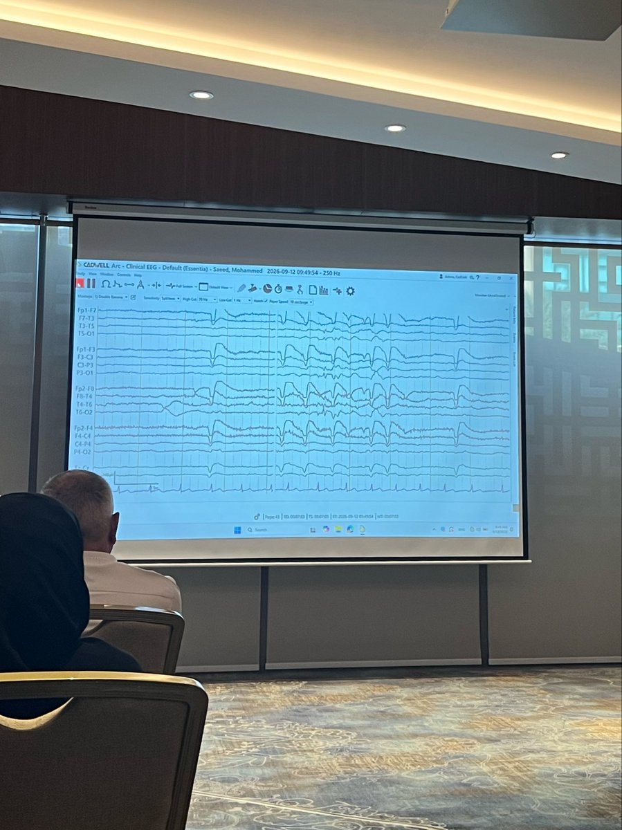 Arina___77's tweet photo. Such an inspiring day at the neuroscience symposium, definitely one to remember 🧠✨. https://t.co/zwMYSZvTHx