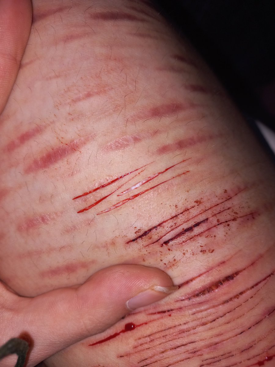 LadyBugBugsie's tweet photo. YERP YERP FIRST POSTTT
This was a while agooo lowk in recovery kinda ? Don't really want to be, but my people care about me 
Hopefully this doesn't get sniped :>
#shedtwt https://t.co/SGOMyoCFTL