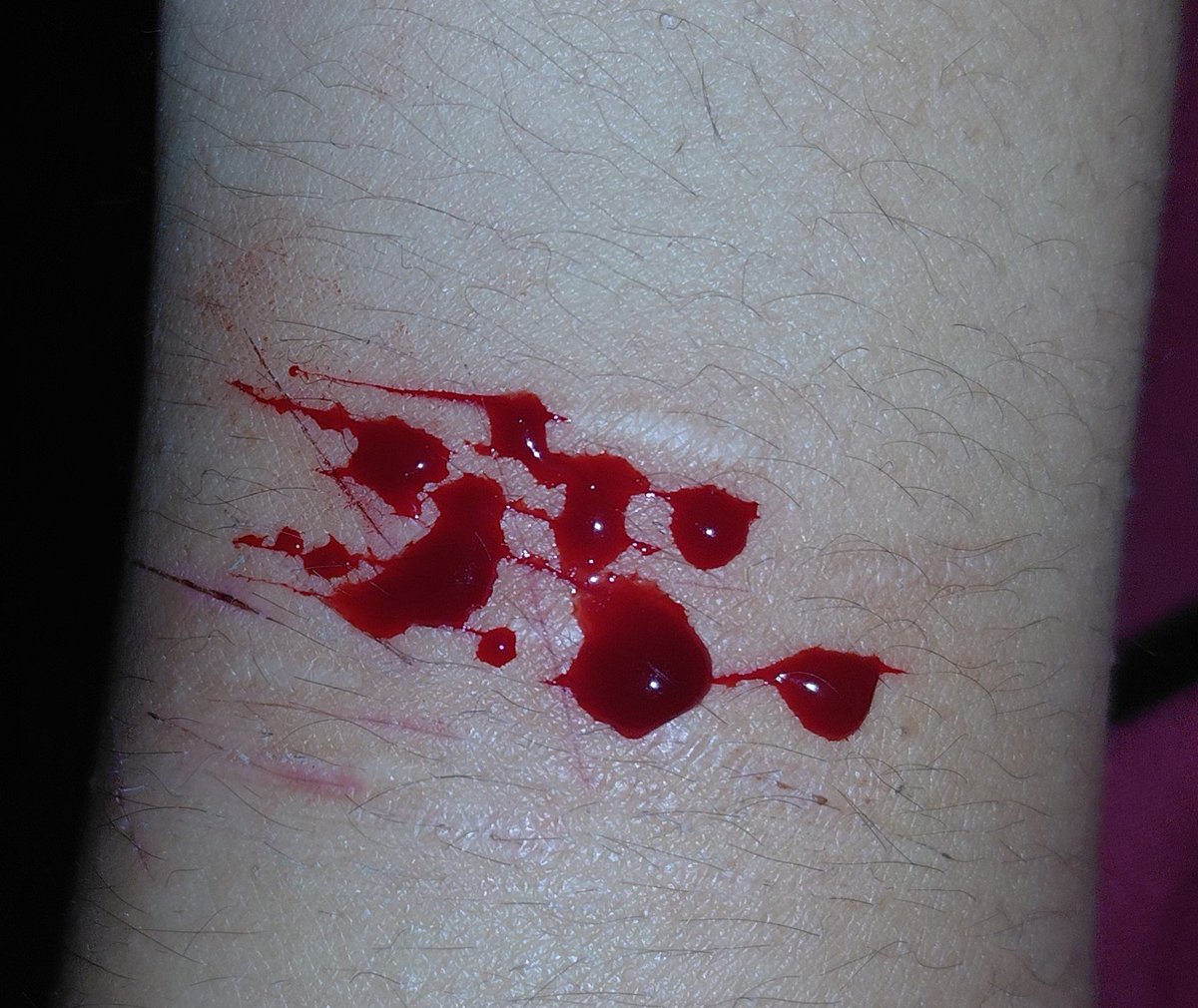 alyissdeaad's tweet photo. bro twitter made me delete yesterdays make up im so pissed...... anyways here's my fake sfx from today... ALL FAKE!!! https://t.co/uN8roNYPRV