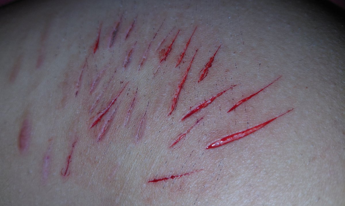 alyissdeaad's tweet photo. bro twitter made me delete yesterdays make up im so pissed...... anyways here's my fake sfx from today... ALL FAKE!!! https://t.co/uN8roNYPRV