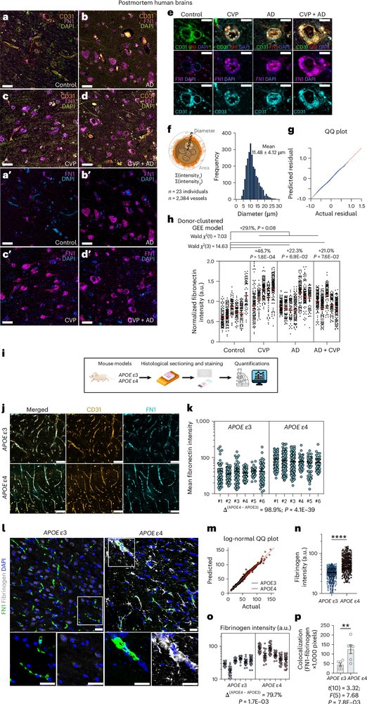 ScienceofPD's tweet photo. Data from experimental models, human brain tissue & clinical datasets identifies fibronectin as a proximal mediator of APOE4-driven gliovascular dysfunction & highlights FN1 as a potential therapeutic target for vascular & BBB dysfunction in #Alzheimers
https://t.co/1YCXpo0ZKE https://t.co/dj8fsjFswG