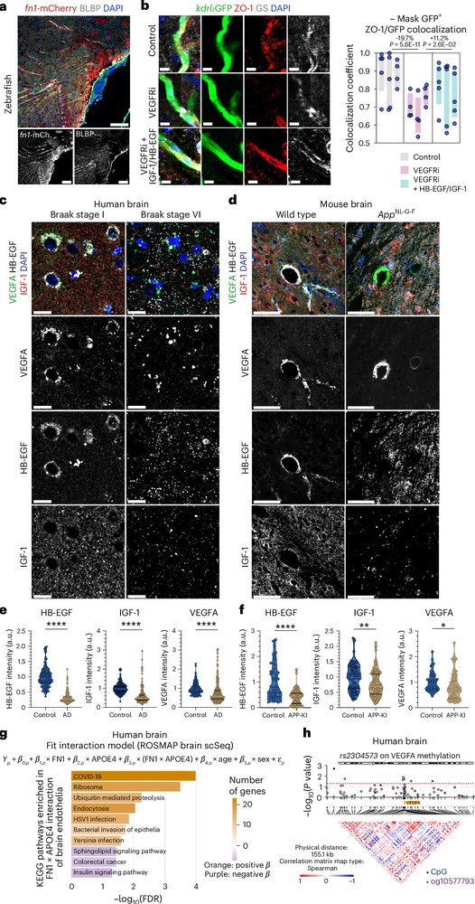 ScienceofPD's tweet photo. Data from experimental models, human brain tissue & clinical datasets identifies fibronectin as a proximal mediator of APOE4-driven gliovascular dysfunction & highlights FN1 as a potential therapeutic target for vascular & BBB dysfunction in #Alzheimers
https://t.co/1YCXpo0ZKE https://t.co/dj8fsjFswG