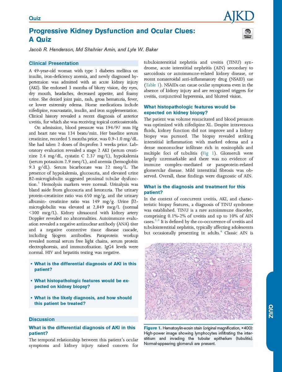 AJKDonline's tweet photo. Progressive Kidney Dysfunction and Ocular Clues: A Quiz

https://t.co/ckiaELaq1o (FREE)

@MDShahrier2 @DrLyleBaker https://t.co/7TnJvEwDNj