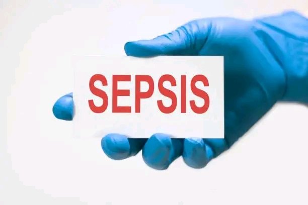 JLAparicioDr's tweet photo. 🟥 Día 🌎 de la sepsis.

#Posgrado de @MINSAPCuba comparte información 🔰
https://t.co/ITGF7oTAs6 https://t.co/DF4A9gYnIH