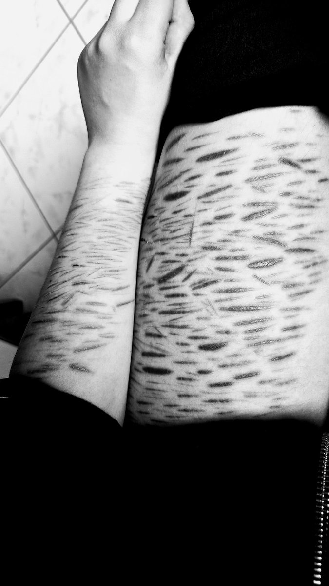 knoxforever15's tweet photo. HEALED! 100% HEALED.!
#shredtwt #scartwt #slittwt https://t.co/ilMvNskz0O