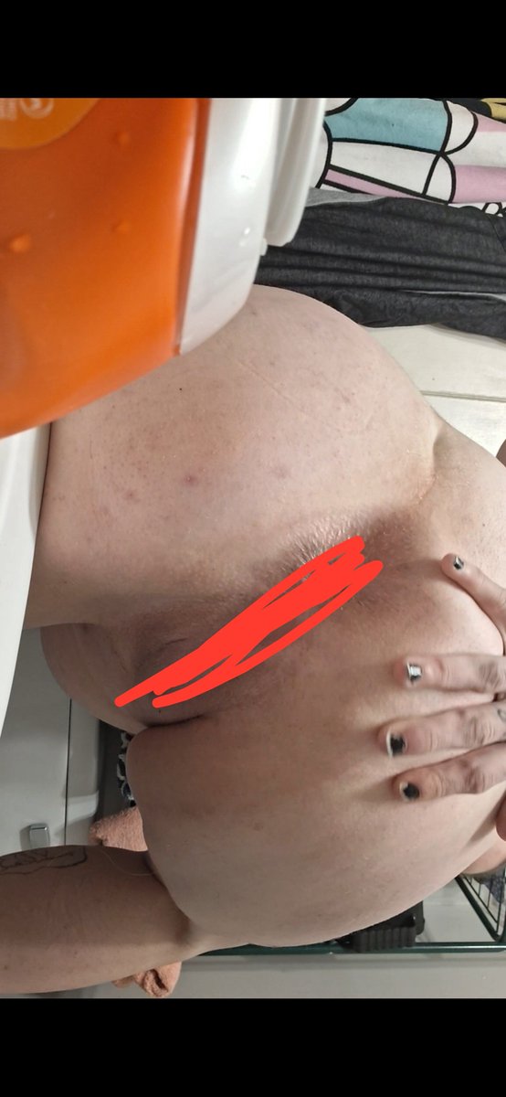 fknradm8's tweet photo. #sellingcontent   ... hmu to see me fully uncensored.  One of the prettiest pussies you'll ever see #buyingcontent i promise u that. #nsfwtwt https://t.co/6U64Mabzjz