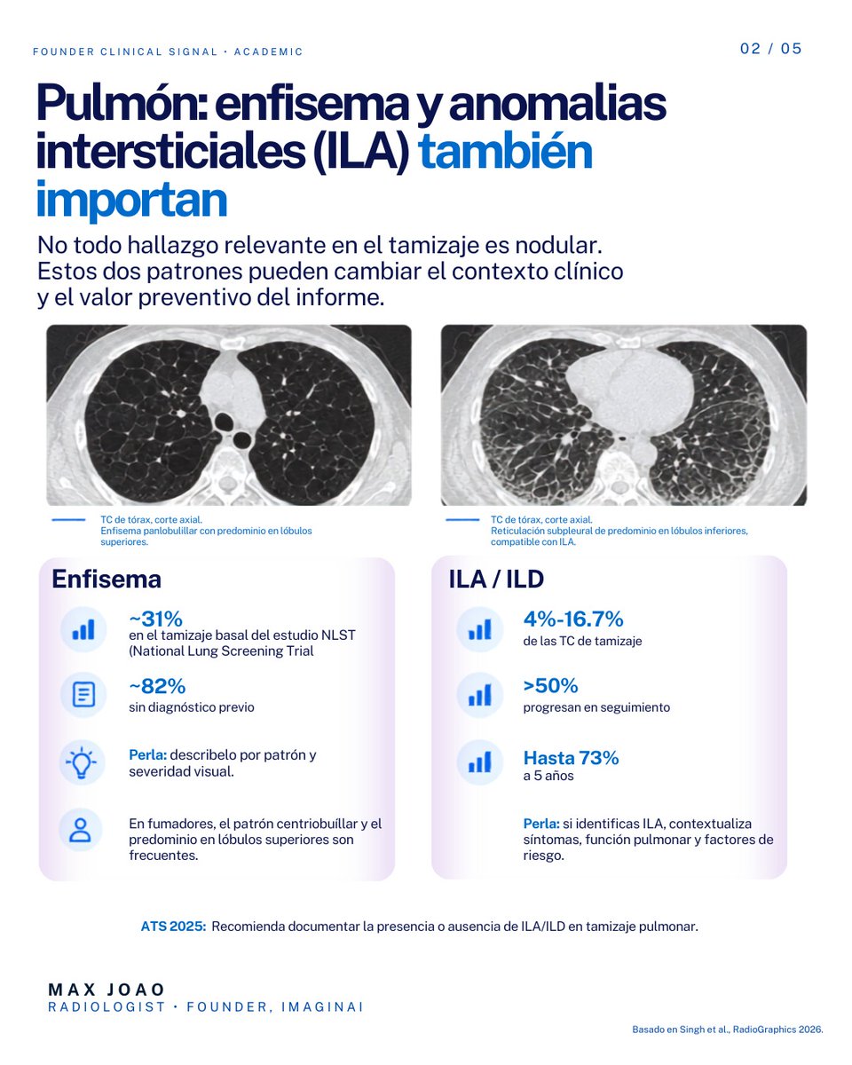dr_maxjoao's tweet photo. Una TC de tamizaje pulmonar puede decir mucho más que “hay o no hay un nódulo”.

Enfisema. Intersticio. Calcio coronario. Aorta. Arteria pulmonar. Hueso.

La información ya está ahí. https://t.co/5NbkSU8wJP