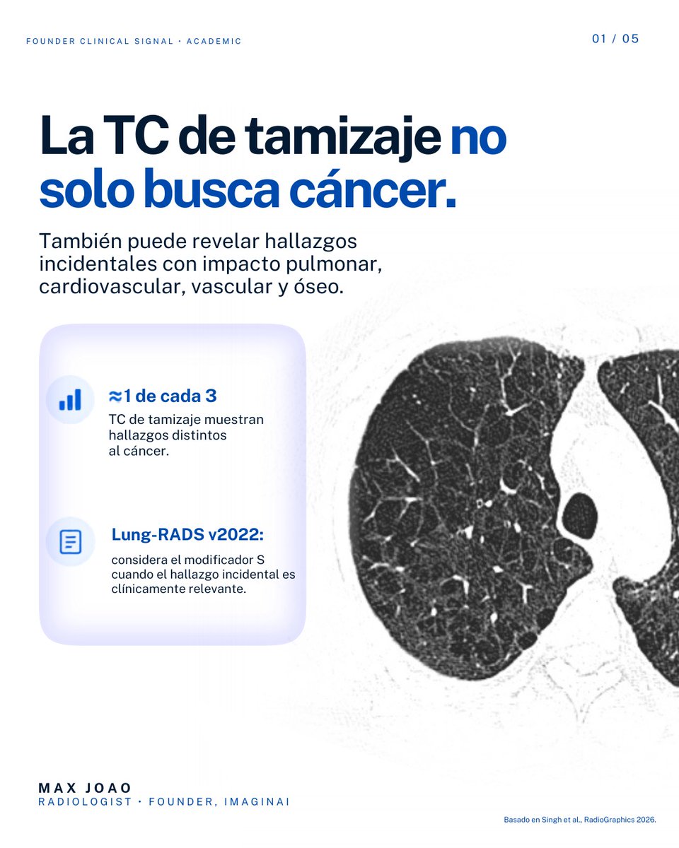 dr_maxjoao's tweet photo. Una TC de tamizaje pulmonar puede decir mucho más que “hay o no hay un nódulo”.

Enfisema. Intersticio. Calcio coronario. Aorta. Arteria pulmonar. Hueso.

La información ya está ahí. https://t.co/5NbkSU8wJP