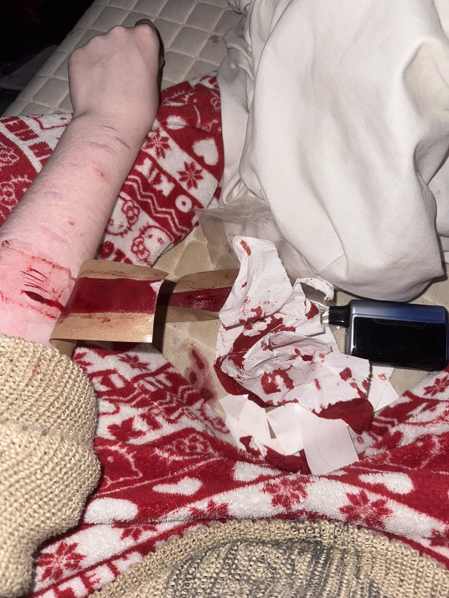 riritoharu's tweet photo. Fuh (FAKE SFX MAKEUP FAKE SKIN NOT REAL HALLOWEEN MAKEUP) https://t.co/TKR8kGPNZT