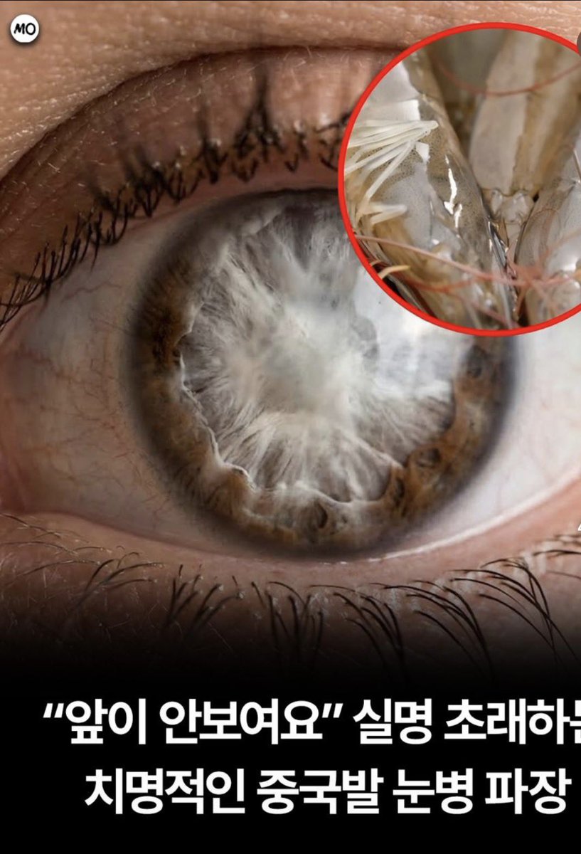 muumging_'s tweet photo. 미칀 중국발 >>노다바이러스<<라고 해산물 손으로 만지다가 눈 실명 될 수도 있대!!해산물 절대 맨손으로 만지면 안되고 손질 후엔 손 깨끗히 씻음 + 전염성도 있어서 평소에도 손 깨끗히 씻고 눈 안비비게 조심하는세 상책인듯 ㅜ조심하자 무섭다 https://t.co/kmkkmfTmhY