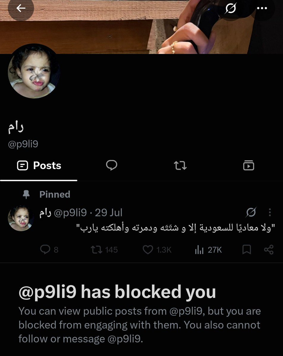 TheHiddenGuide4's tweet photo. الشرموطة الرصاصية رام قالت أن الحوثيين يسوون بلوك لها وجبناء من خلف الشاشه وما ادري وش 
في خلال دقايق وانا اغسل شعري قبل ما اروح الشركه غسلت كسمها هي والرصاصيه الثانيه على السريع كذه لحد ما رجعت في كلامها وبلكتني الجبانة 😁😂😂 https://t.co/hfbNSatLsm