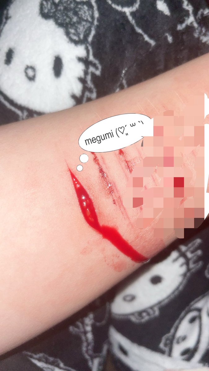 fushiguropup's tweet photo. old, but i still love very much, i wanna recreate it so bad again; might do so :3 
scarred already. 

SFX MAKEUP, NOT REAL! 
#shtwt #ouchietwt #988twt 🪒🪽 https://t.co/Q7Y5iphShT