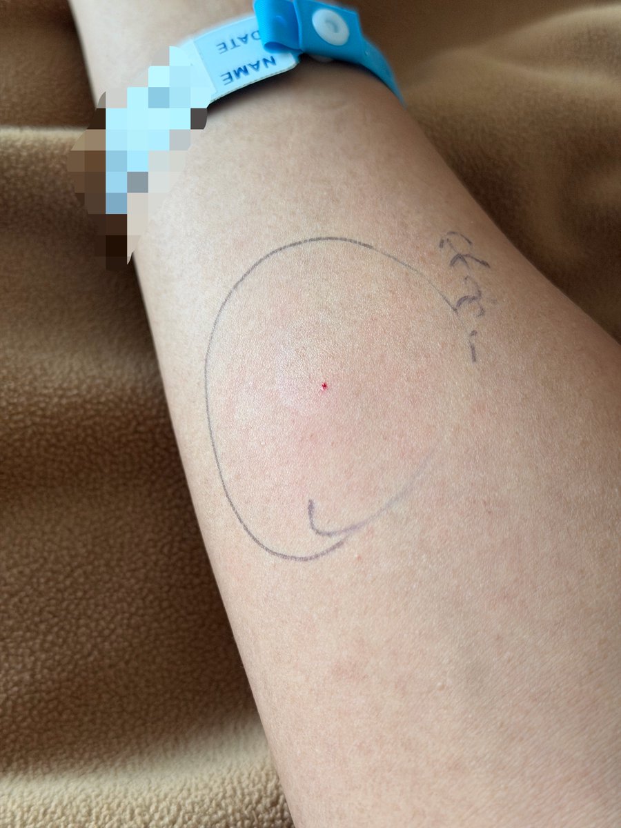 afrkml's tweet photo. Suntikan paling SAKIT adalah suntikan intradermal buat ngetes alergi antibiotik nih hhh 😩😩😩

Tapi ngebuletinnya knp gede banget dah kaka nersnya haha 🤣 https://t.co/PZD86R30Au