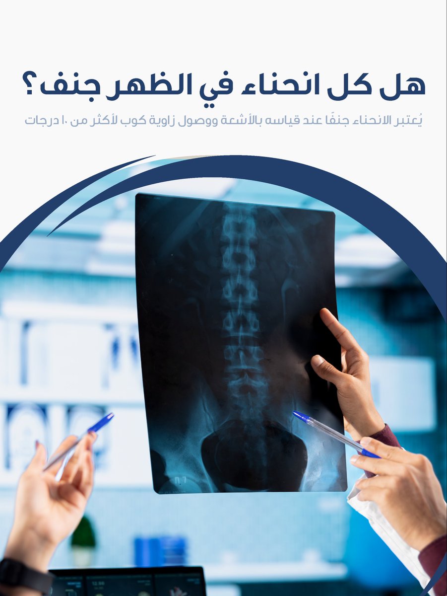 Medicalmotioncl's tweet photo. المظهر الخارجي وحده لا يكفي لتحديد الجنف، فالتشخيص يعتمد على التقييم والقياسات اللازمة لمعرفة درجة الانحناء
ابدأ بالتقييم المتخصص مع ميديكال موشن 🩺

📞 للحجز عن طريق الرقم: 0531950111

#ميديكال_موشن #MedicalMotion #الجنف #Scoliosis https://t.co/c3CFNC9jhB