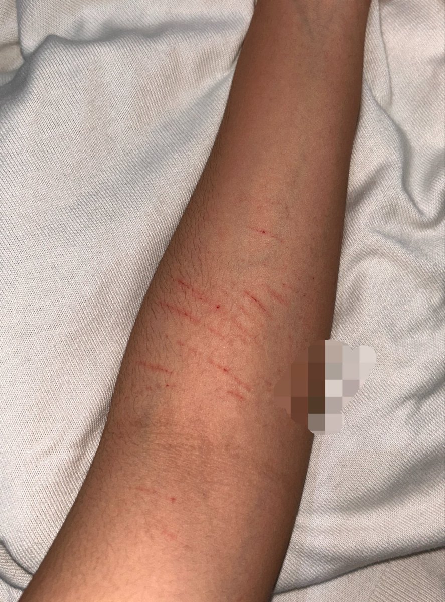 recordear's tweet photo. cat scratches https://t.co/2MGB1MGj8y