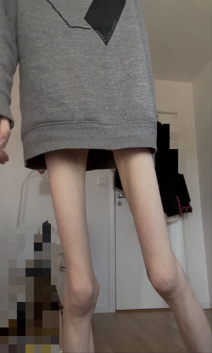 foodlov2000's tweet photo. bc 

/In this photo, my BMI is 13👀/ https://t.co/5rj4QMaWUQ