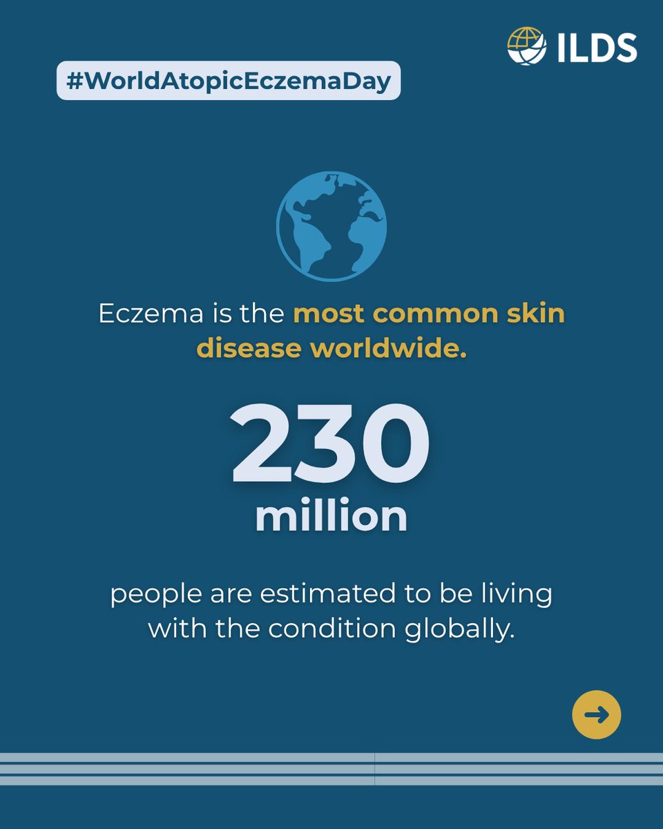 ILDSDerm's tweet photo. Atopic eczema affects 230+ million people worldwide, yet its medical, social and economic burden often goes unseen. This #WorldAtopicEczemaDay, we support #BreakTheInvisibleBurden and the global work of @globalADatlas to improve understanding and care.

https://t.co/Sr8cSpWVax https://t.co/LkdP7OR4ED