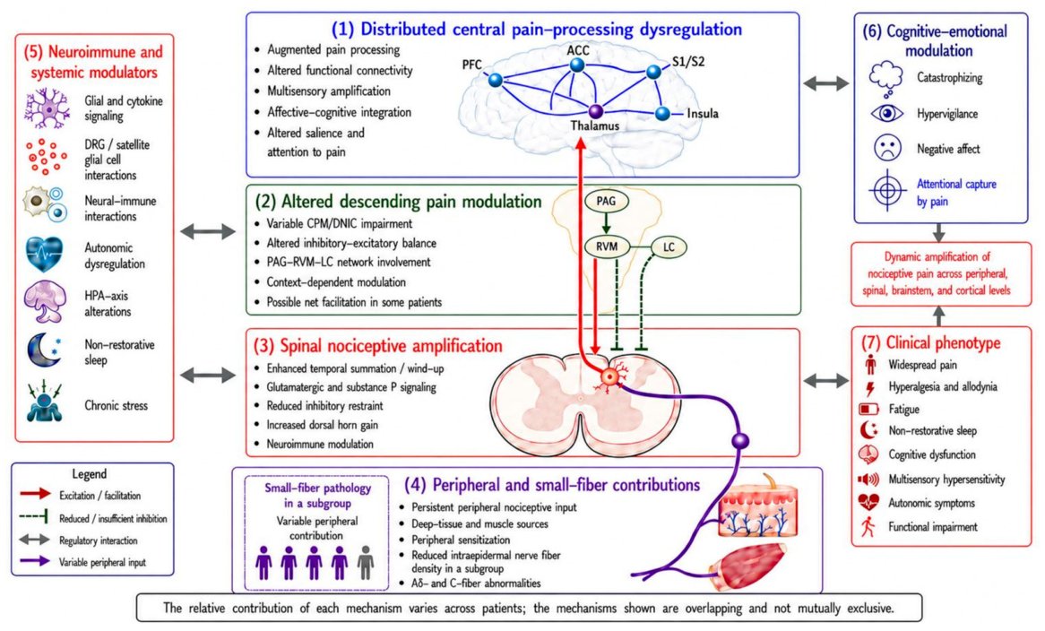 PhysioMeScience's tweet photo. Pain Mechanisms in Fibromyalgia: An Integrative Narrative Review of Central, Peripheral, Neuroimmune, and Psychobiological Factors

https://t.co/dc9oHiPqqE https://t.co/Ug0mfNq6gM