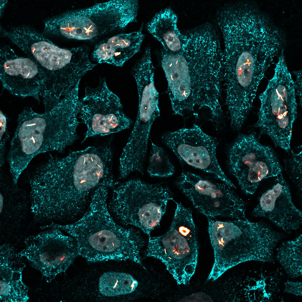 _Viroscope's tweet photo. Nuclear Stars and Viral Auroras ✨

Red-hot nuclear constellations are frozen inside grey microcosmic vaults, while a bright viral aurora washes across the cytoplasm

🔴|🟠: Mx1-L7A
🔵: Influenza A virus nucleoprotein
⚪: Nuclei 

🔬: Joe McKellar

#SciArt #MicroscopyMonday https://t.co/9LvqBQZyHO