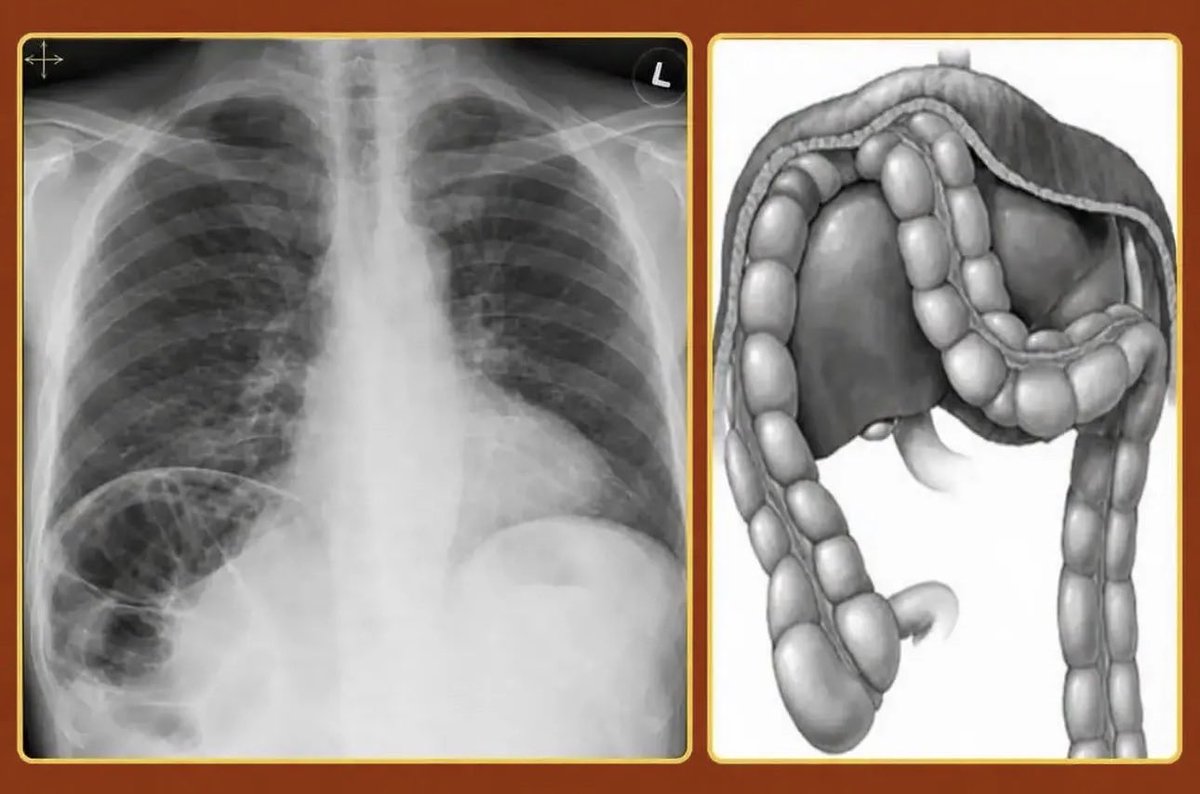 OGdukeneurosurg's tweet photo. Diagnosis? It can be misunderstood on imaging. https://t.co/DFuauXHkJp