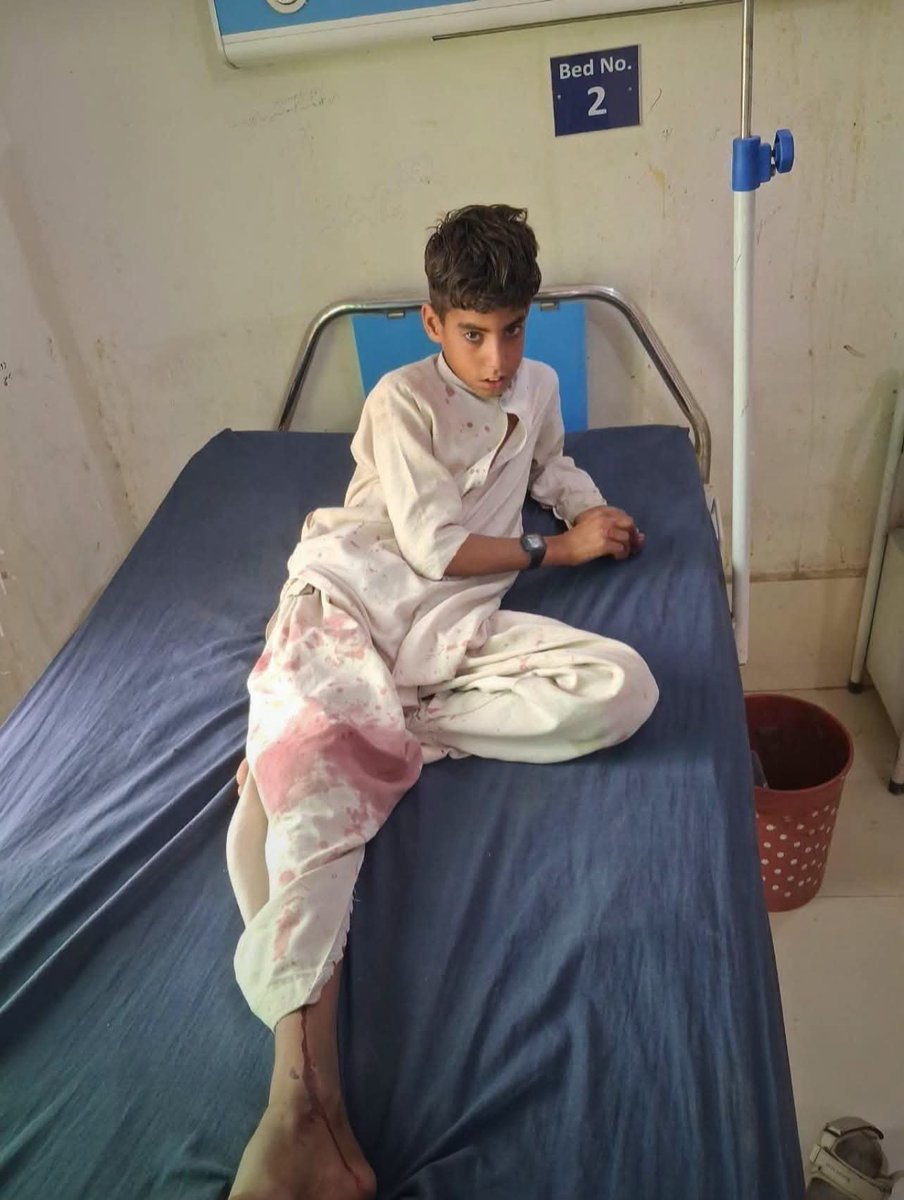Falcon_24Off's tweet photo. In South Waziristan, two children were injured when an old landmine reportedly planted by the Pakistani military exploded. https://t.co/10hDQByRWX
