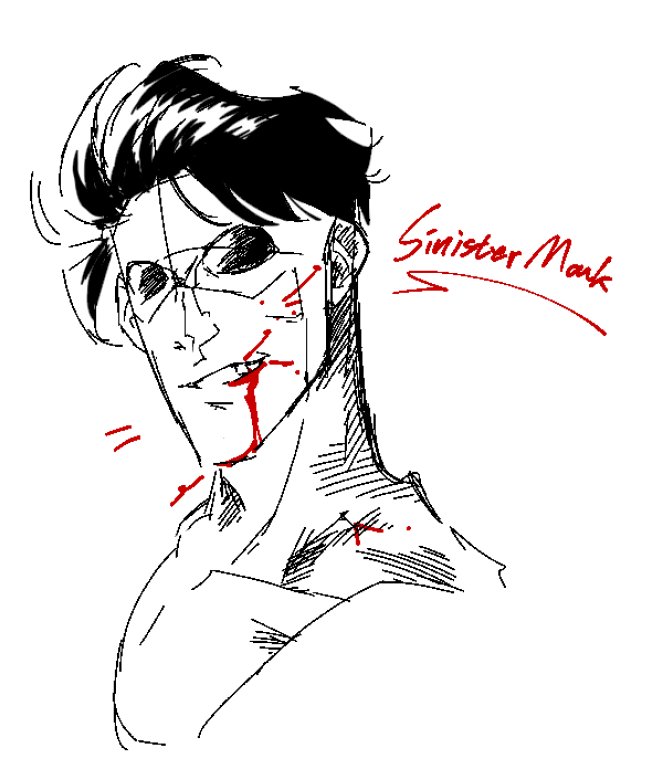 MMMIDDYYY's tweet photo. my righthand thumb is hurting more and more😞💔……#sinistermark https://t.co/Mi6H8lmmOV