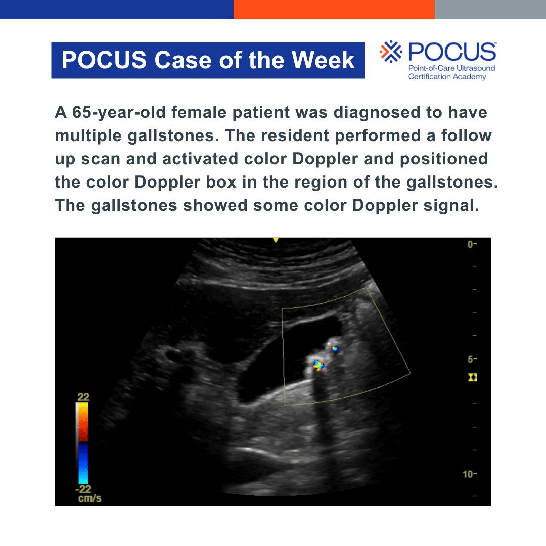 POCUSAcademy's tweet photo. π£ Case of the week!
Let us know your answer in the comments!
#POCUS #POCUSCaseStudyChallenge https://t.co/gDw1gTNM8F