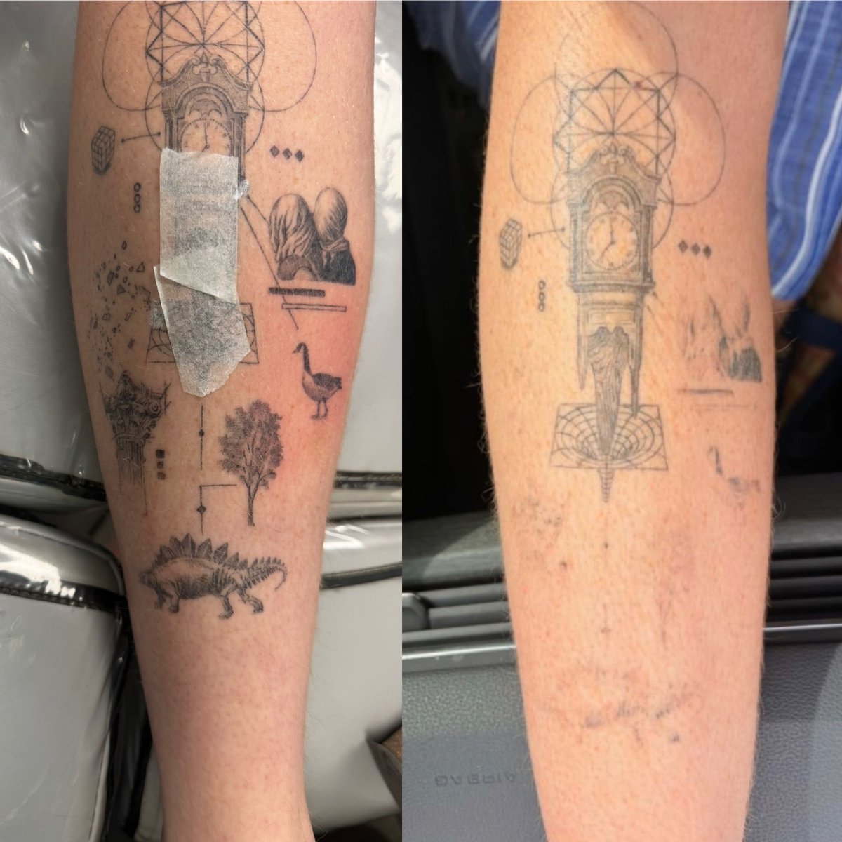 TT_LaserGrl's tweet photo. TWO Treatments #makewisechoices #wisechoice #Denver #colorado #PicoSure #Picosurelaser #picosuretattooremoval #laser #lasertattooremoval #tattooremoval #tattoos #ink #fyp https://t.co/JubjSwBwED