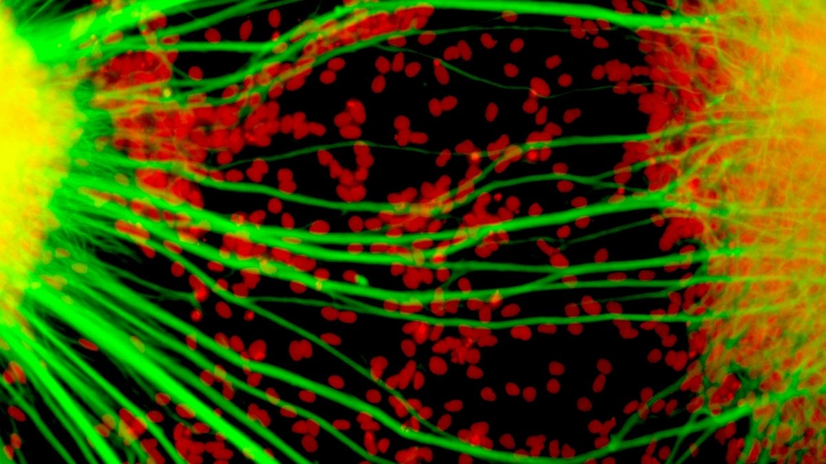 ISS_CASIS's tweet photo. These glowing threads are human neurons growing inside a brain organoid. Researchers at @UCSanDiego and @NationalSCF are sending brain cell models to the ISS to study aging, neurodegeneration and disease. Read more: https://t.co/YW4pYFjwg0

#BrainOrganoids https://t.co/67WF6yzpsQ
