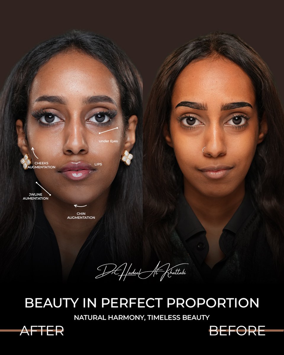 SenaidaMaher's tweet photo. Beauty in perfect proportions ✨ https://t.co/bRfSWYBjr1