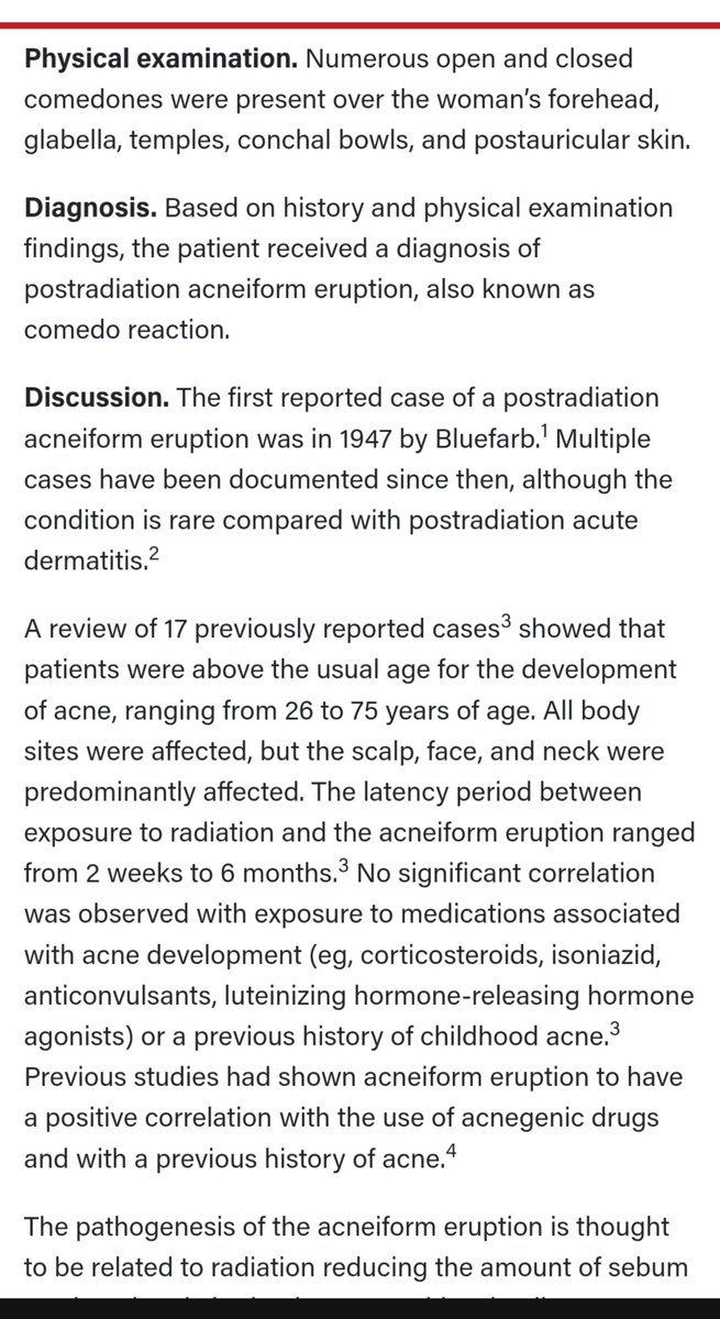 citizenshiper1's tweet photo. @crystalshen6 That seems accurate *Post-radiation Acne-iform Eruption" 🤔⚖️📸 #Acne #HavanaSyndrome #LRAD #FreyEffect @RepLuna @DHS_Wolf @disclosetv ⚖️🔎 https://t.co/gJ2qiLAEdC