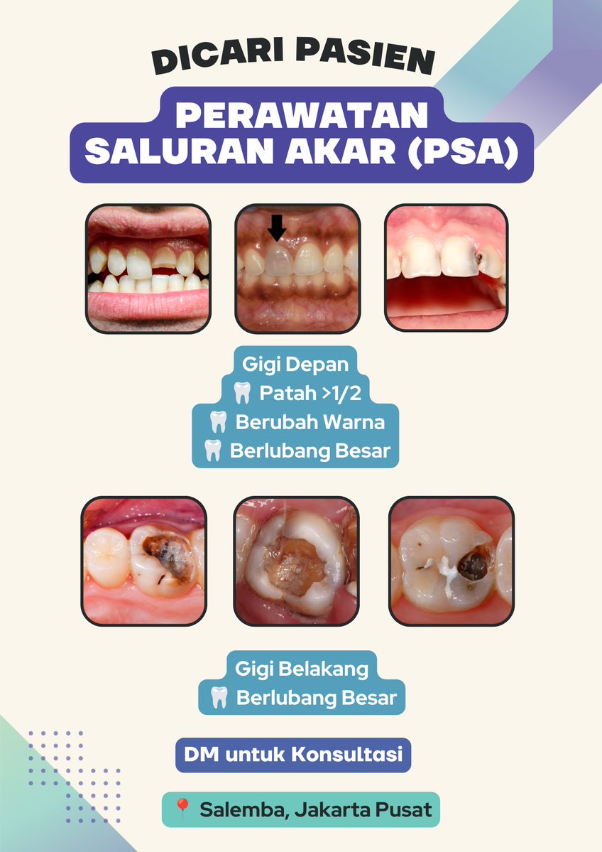 nlndiva's tweet photo. Haloo, aku sedang mencari pasien untuk Perawatan Saluran Akar (PSA). Boleh langsung DM yaa! ✨🤗

#koasgigi #koasgigijakarta #perawatangigigratis #caripasien #psagigi #perawatansaluranakar #caripasienkoasgigi #koaslife https://t.co/7bRqQQCg7q
